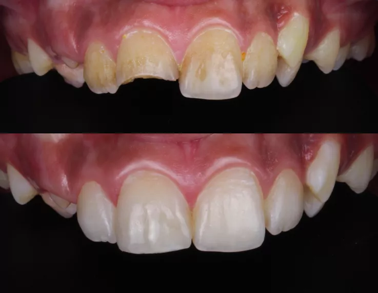 restoration swasthya dental and wellness center